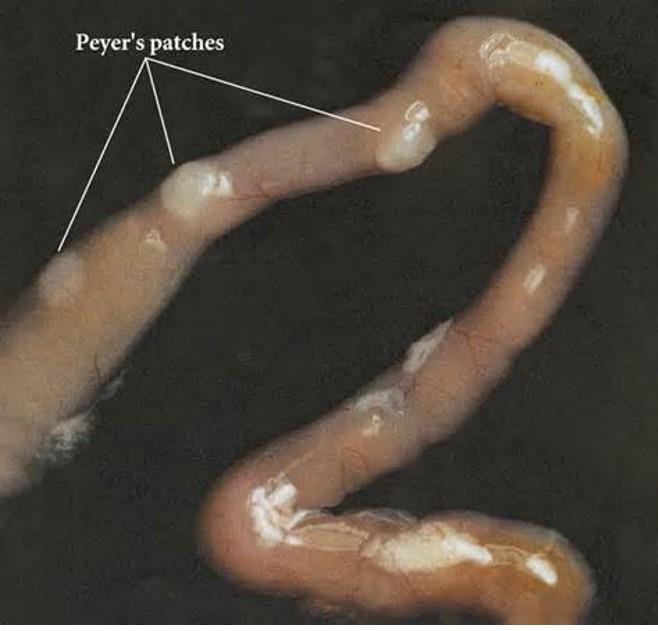 Peyer s Patches Small masses of lymphatic tissue found throughout ileum region of small intestine roughly