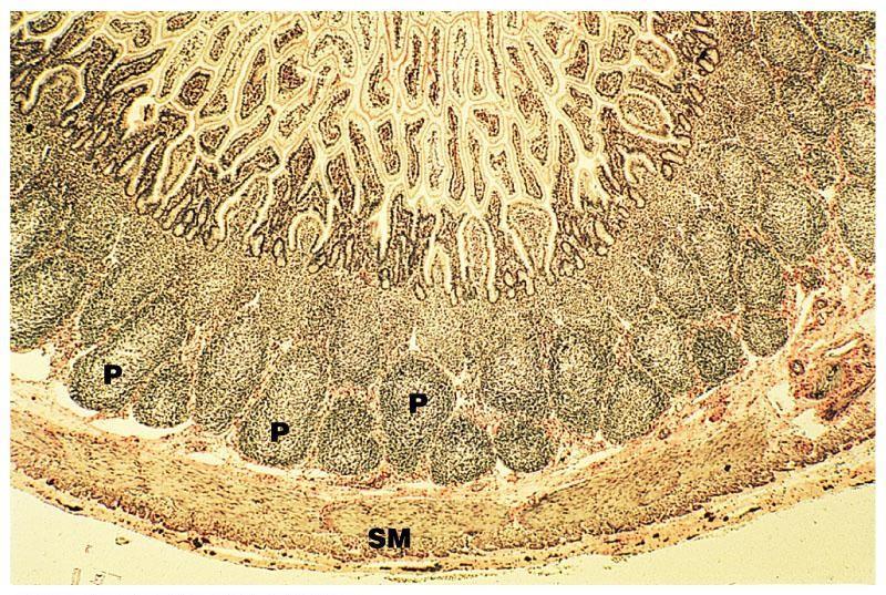 pathogenic microbes in the ileum Appendix The location of the appendix is close to the junction of the large
