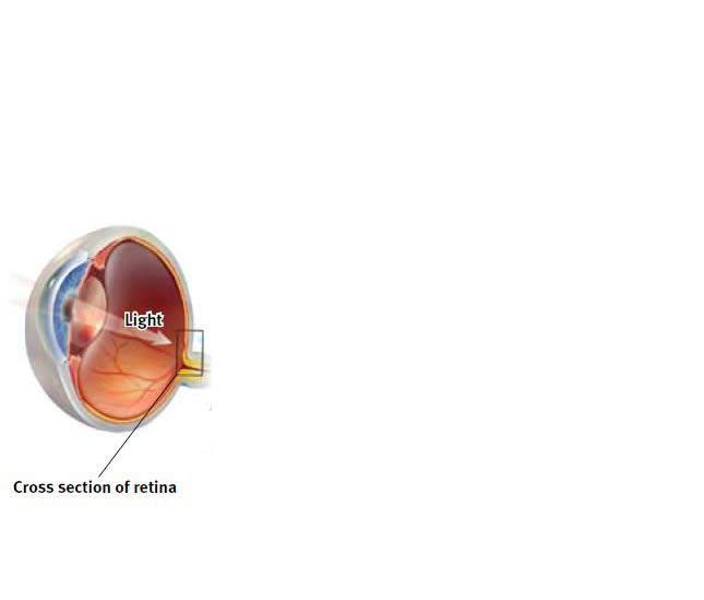 The Retina s