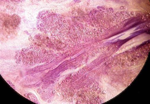 A - Conventional 3D histology images of small breast cysts containing