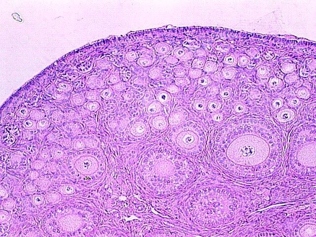 OVARIAN FOLLICLES In ovarian follicles there are