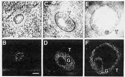 FSH receptors in the granulosa cells mrna for