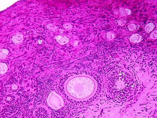SECONDARY or PREANTRAL FOLLICLE Follicular growth (granulosa cells proliferation) depends on FSH secretion