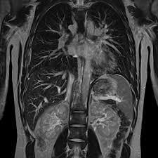 Radiological Modalities Plain X-Ray CT Angiography Nuclear