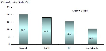 (%) Normal LVH HCM Amyloidosis Longitudinal