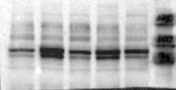 Western Blot analysis with