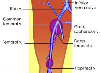 NOMENCLATURE CHANGES TO THE DEEP SYSTEM Inguinal crease to knee External Iliac Vein - EIV Common Femoral Vein - CFV