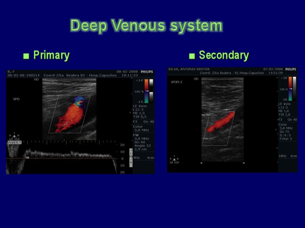 Fig.: The Deep venous system-