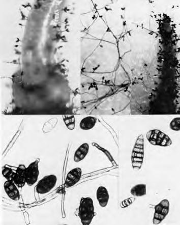 Fig. 1. Top: conidiophores and conidia of Alternaria radicina and chains of conidia of the saprophyte A.
