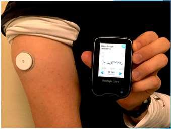 Blood sugar sensing technology Freestyle Libre Can