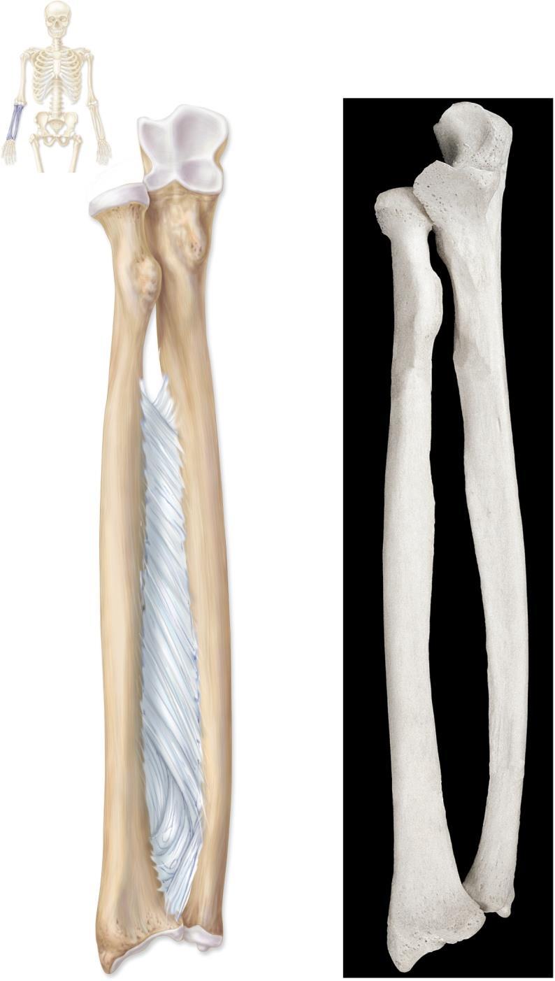 Radius and Ulna Copyright The McGraw-Hill Companies, Inc. Permission required for reproduction or display.