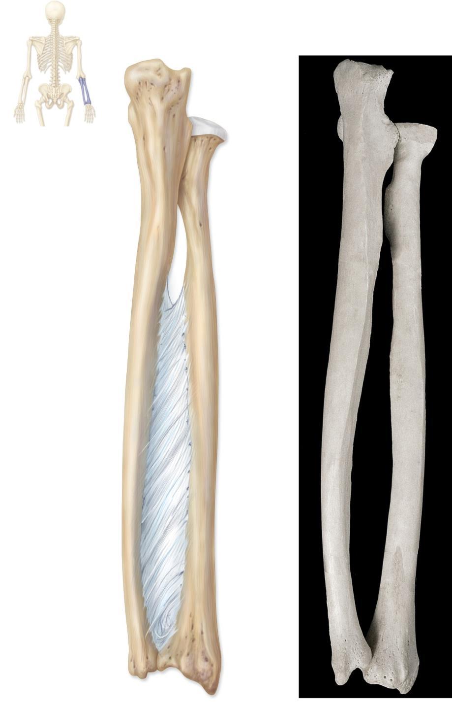 Radius and Ulna Copyright The McGraw-Hill Companies, Inc. Permission required for reproduction or display.