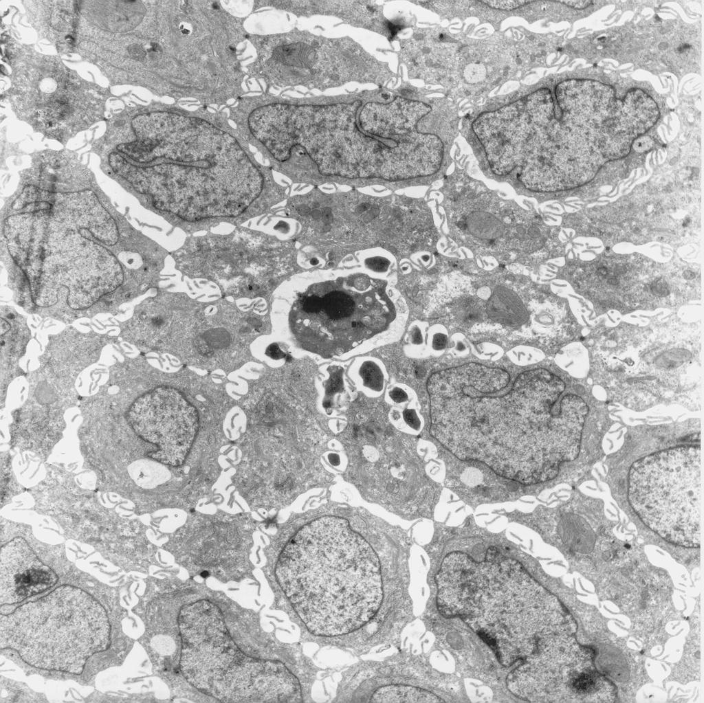 200 ANNALS NEW YORK ACADEMY OF SCIENCES FIGURE 5. Transmission electron micrograph of a section through the basal part of intestinal epithelial cells forming an apoptotic rosette.