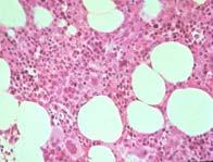 Blood is Made in the Bone Marrow Axial skeleton Inner spongy bone Bone marrow is in the holes Bone marrow is a highly organized/ regulated organ TED07_4.