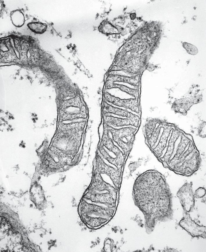 2 Answer all the questions. 1 (a) Fig. 1.1 is a high power electronmicrograph of some mitochondria.