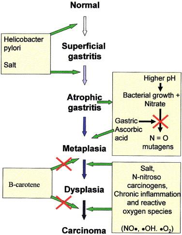 Correa Modell of Gastric Carcinogenesis