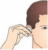 Diagnosis Based on your symptoms and medical history, your doctor may suspect an eardrum perforation.