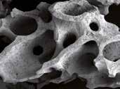 Contact osteogenesis Newly formed bone is in direct contact with the stable BEGO OSS particles.