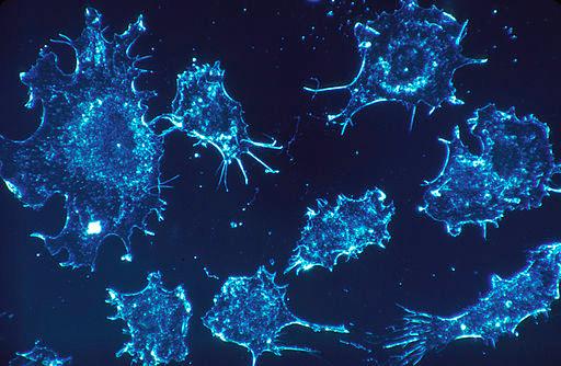 Cancer Cells [Photo by Dr.