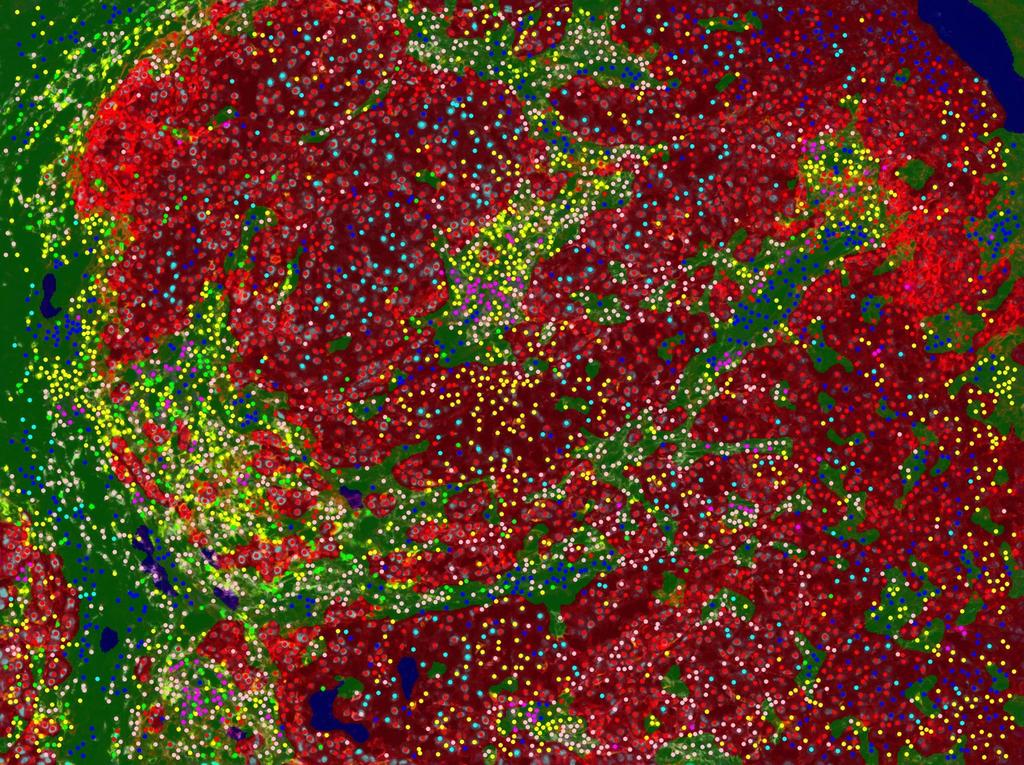 Phenoptics multiplexed IHC - Opal With tumor detection and cell phenotyping Tissue segmentation red = tumor PD-L1 green = stroma yellow blue=background = CD8 green = Foxp3 red = PD-L1+ tumor