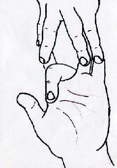 Figure 9. Extensor tendons are arranged into six compartments over the dorsum of wrist. Figure 8. Testing the integrity of flexor digitorum superficialis.