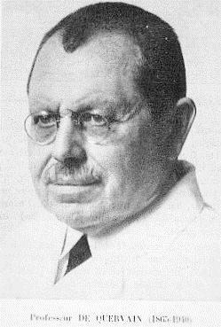 History First described in 1895 by Dr Fritz De Quervain (1868-1940) Later American surgeon Dr Harry Finklestein