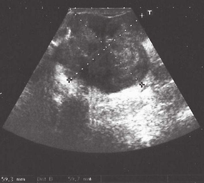 HR 2 1 3 Fig. 1. B-mode ultrasound image of the scrotum.