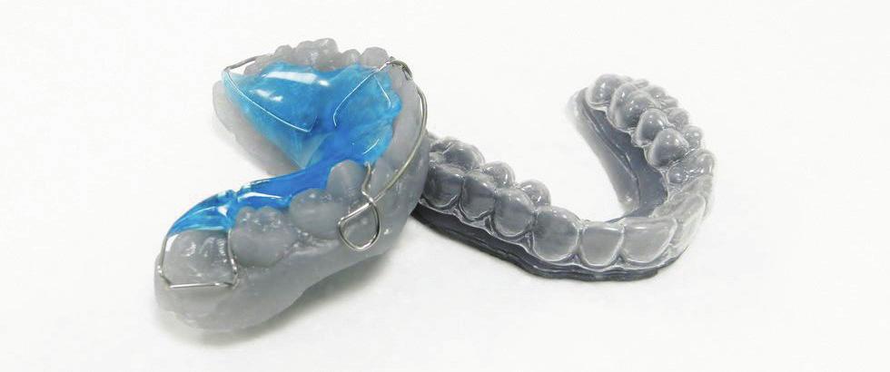 Application: Orthodontic Models Cost-effective vacuum-formed appliances, in house.