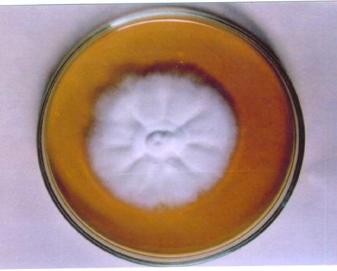 colony characteristics by isolating organisms on Sabouraud s dextrose agar (SDA) with chloramphenicol and cycloheximide and