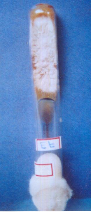 flocosum b) Chlamydospores with pectinate hyphae