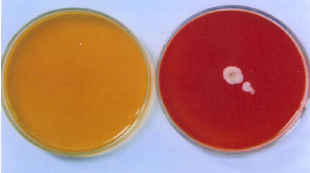 Reddy KR. Fungal Infections (Mycoses).