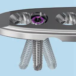 5 is part of the VA-LCP Periarticular Plating System, which combines variable angle locking screw