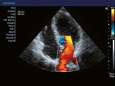 2D-mode imaging. Color Doppler exams. Cardiac screening. Decide what is needed and when.