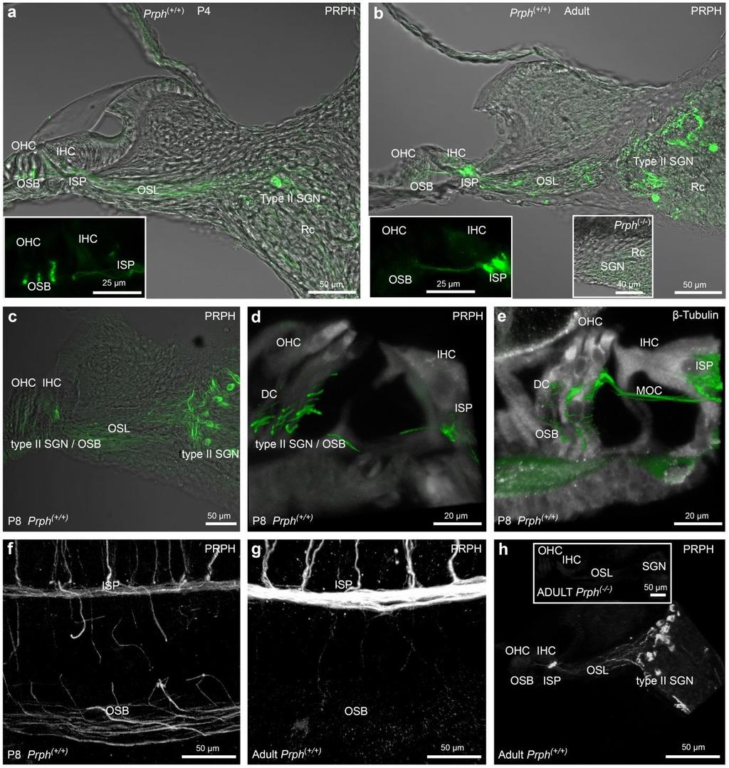 Supplementary Figure 1. Identification of the type II spiral ganglion neurons (SGN) via immunofluorescence of peripherin protein (PRPH).