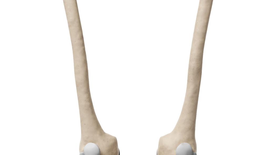 Pelvis Hip joint Femur