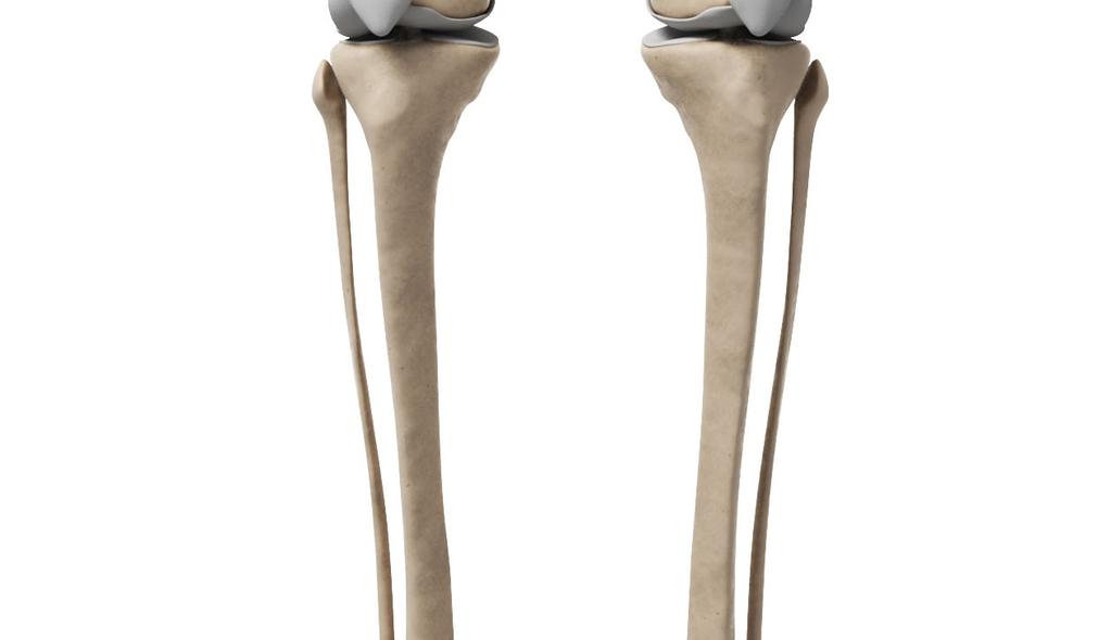 joint Fibula Tibia Foot