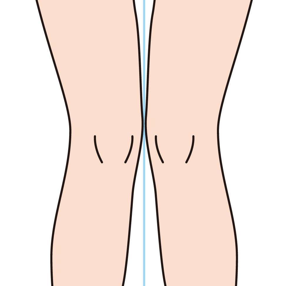 with the legs parallel, the medial
