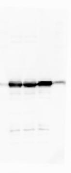 cropped immunoblots. Blue labels on top indicate the antibody used for detection.