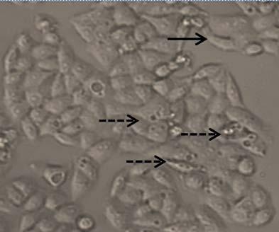 cells (B4), normal cell morphology, change in cell morphology B4 DISCUSSION According to Teng et al.