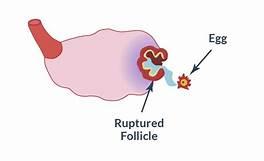 OVULATORY GONADOTROPIN SURGE AND OVULATION Follicle rupture is also due to the following factors: 1.