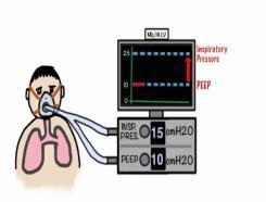What is NIV? NIV refers to the provision of ventilatory support through the patient s upper airway using a mask or a similar device.