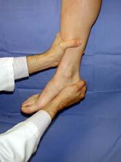 Foot and Ankle Physical Exam The Big Picture: - Gait analysis - Exam standing - Exam sitting - Provocative maneuvers 1. Gait analysis Physical Exam 2. Examination Standing Alignment Swelling 3.