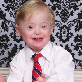 Other Ways You Can Help HOST A DRESS DOWN FOR DOWN SYNDROME DAY The Triangle Down Syndrome Network invites your school, company or organization to participate in a Dress Down for Down Syndrome Day.