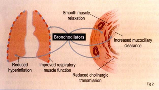Bronchodilators Increase FEV1, improve exercise performance, reduce dynamic hyperinflation Beta 2 agonists SABA (albuterol) LABA (formoterol,