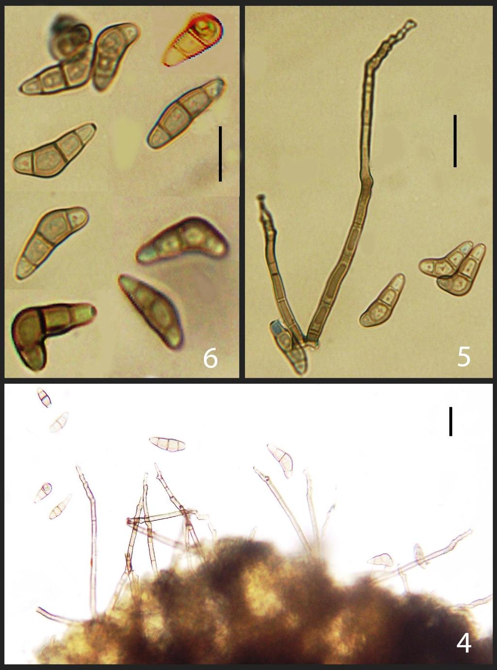 Figs 4 6 Curvularia martyniicola, microphotographs (AMH 9701, holotype).