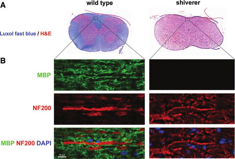 SUPPLEMENTARY FIG. S3. Histological confirmation of a lack of compact myelin and MBP expression in the shiverer mouse CNS.