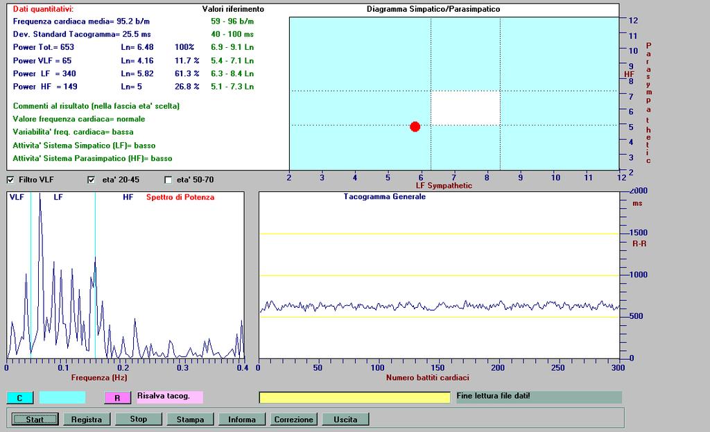 Figure 1. HRV Analysis, subject at rest, identification number: E.R. 22-04-2014 The instrument gives the results in Italian that we translate to aid this discussion.