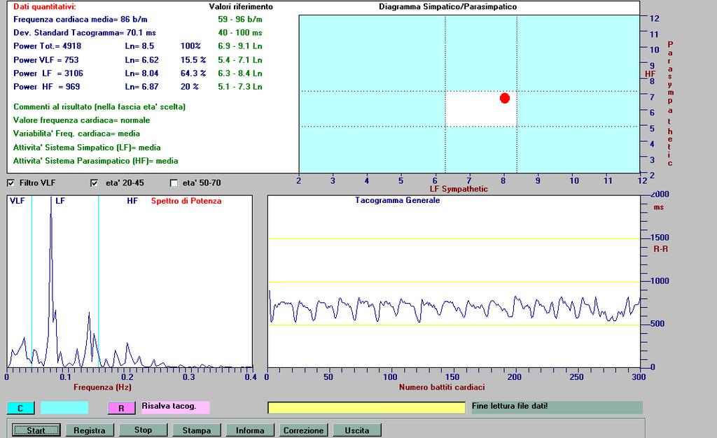 Figure 2. The HRV analysis of the same subject with recording performed within a regime of controlled respiration. HRV Analysis, subject under controlled respiration, identification number: E.R. 22-04-2014 The Fast Fourier Analysis confirms that the recording was performed within a regime of controlled respiration with net peaks ranging about 0.