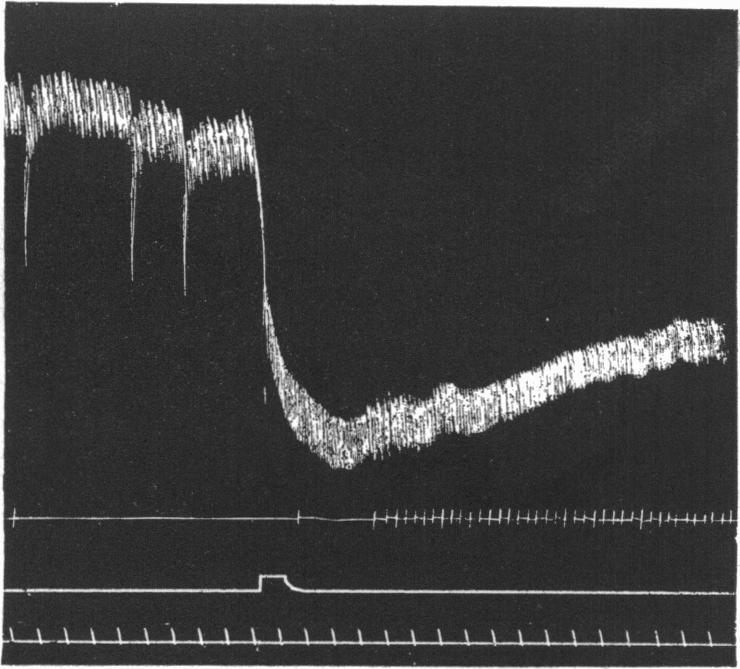 Effect of injecting 5 c.c. of secretin solution from monkey. -Blood-pressure zero 36 mm. below signal. Fig. 3. Same experiment.