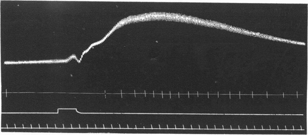 PANCREA TIC SECRETION. the depressor effect was even more marked than in the case of the dog, and was often associated with vagus inhibition of the heart.